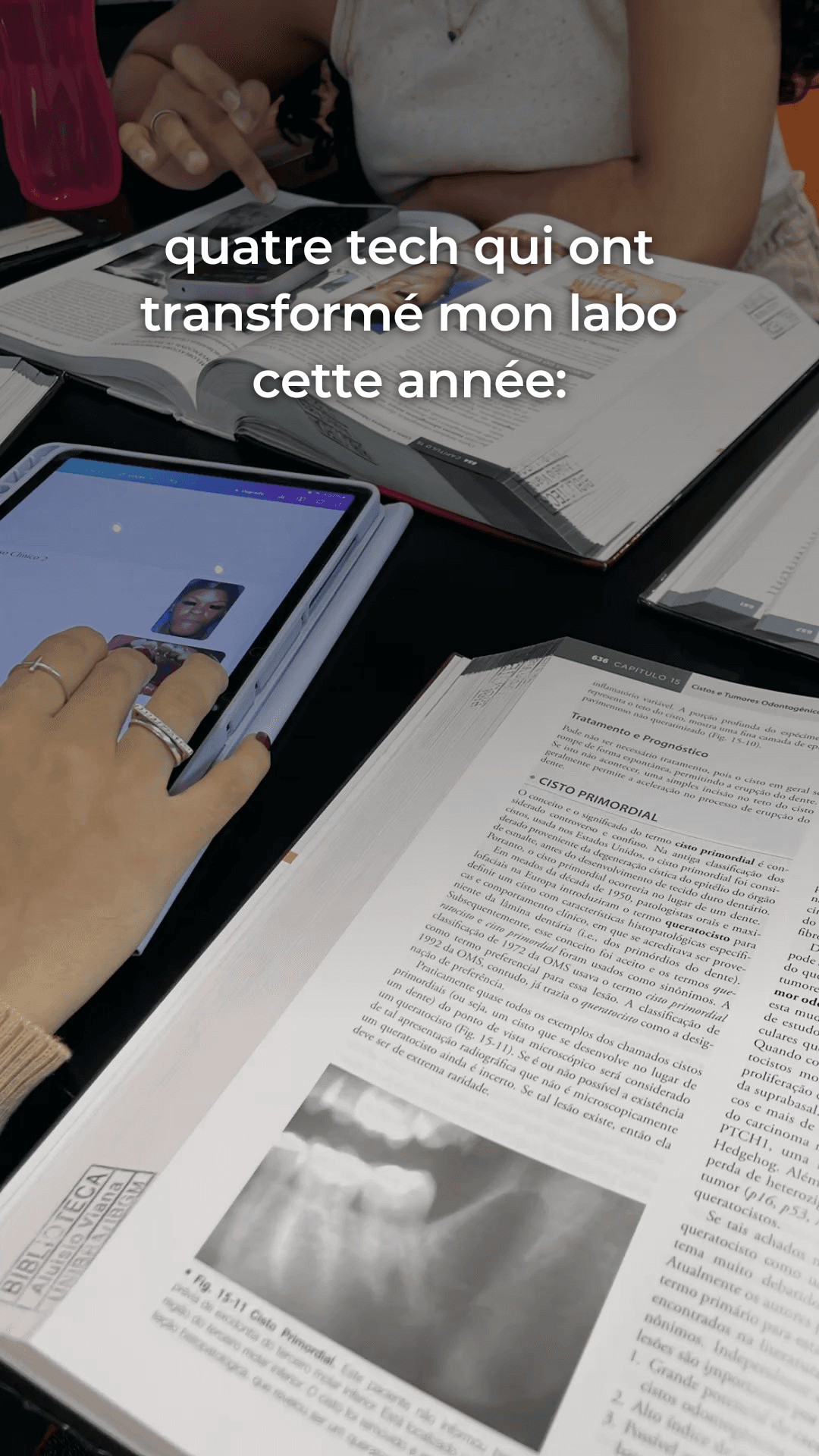 Carrousel TikTok généré par Lumetria